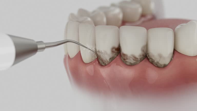 Reliable Wisdom Tooth Removal contractor in Oceana County County, MI by Dentist Open Now